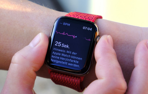 Die Apple Watch kann jetzt EKG in Deutschland